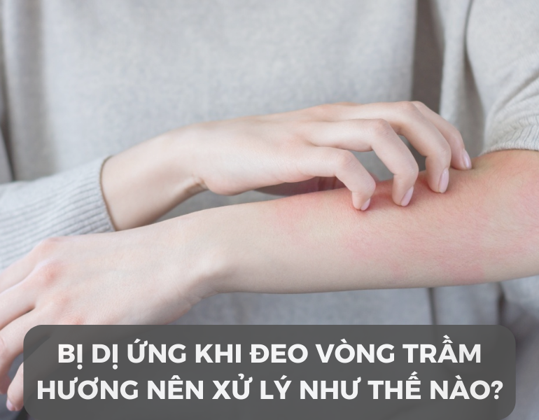 Bị dị ứng khi đeo vòng trầm hương nên xử lý như thế nào?